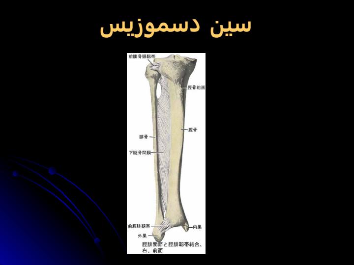 پاورپوینت اموزش اسیب