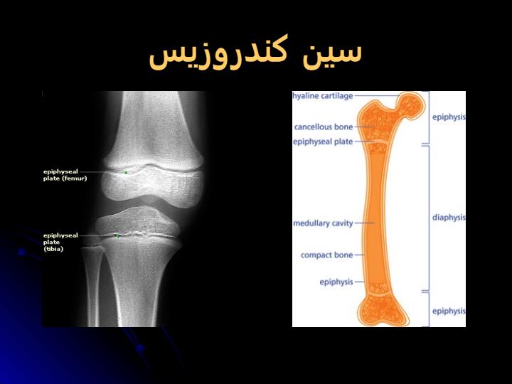 پاورپوینت اموزش اسیب