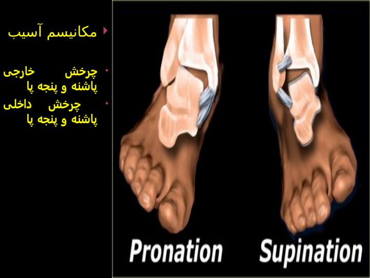 پاورپوینت آسیب های مچ پا و پا 