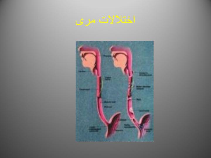 اختلالات-مری1