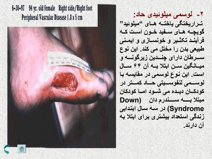 بلاد-کنسر6