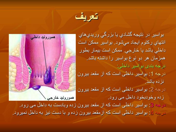 بواسیر3