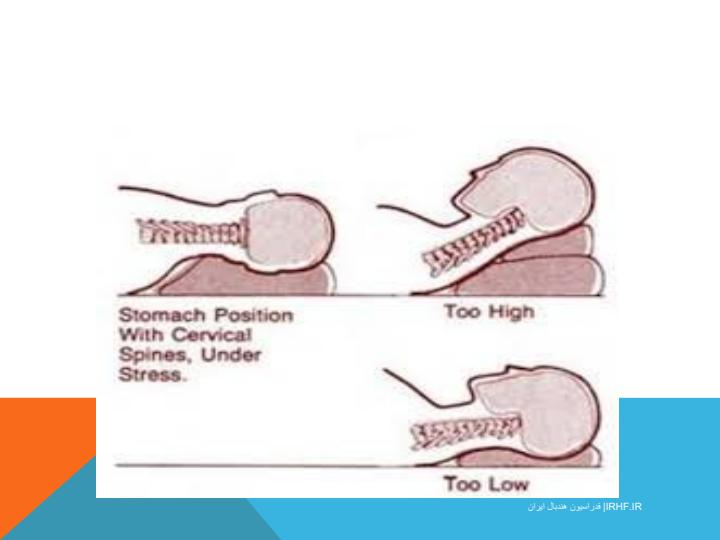 عارضه-سر-به-جلو-حركات-اصلاحي-و-درماني5