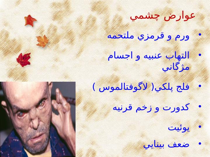 عوارض-جذام4