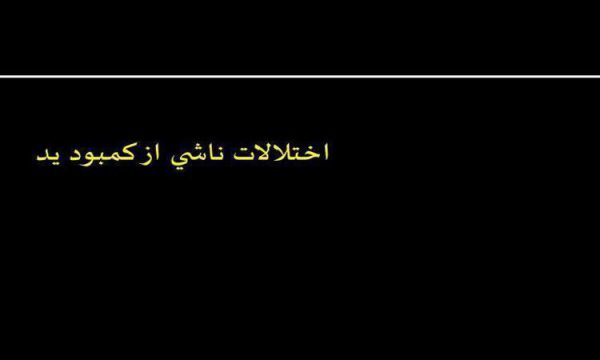 اختلالات-ناشي-از-كمبود-يد