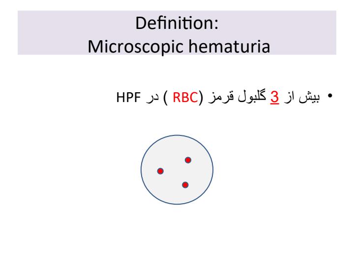 هماتوریا4