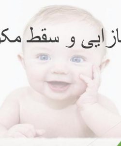 نازایی-و-سقط-مکرر-