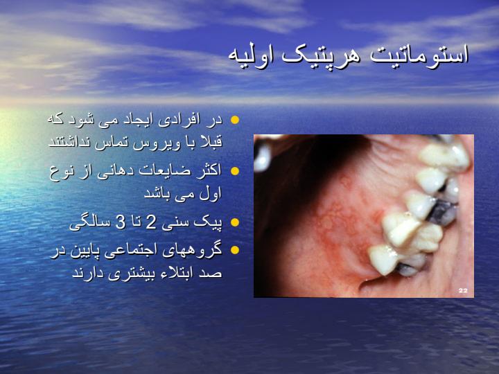 آفت-و-هر-پس-و-تشخیص-افتراقی-و-درمان3