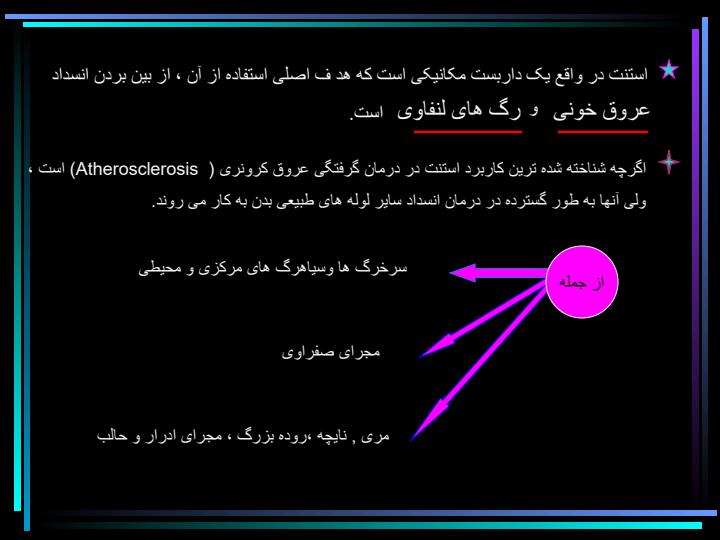 استنت3