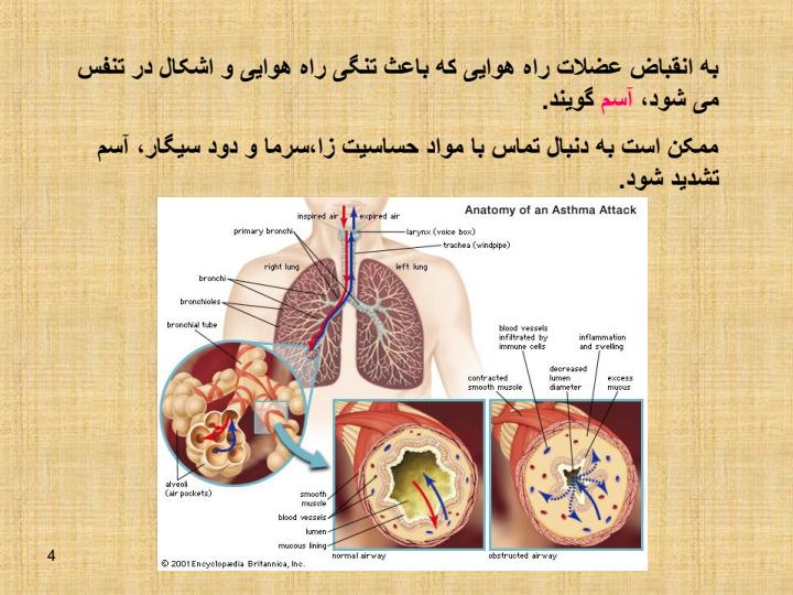 اسم-تشنج3