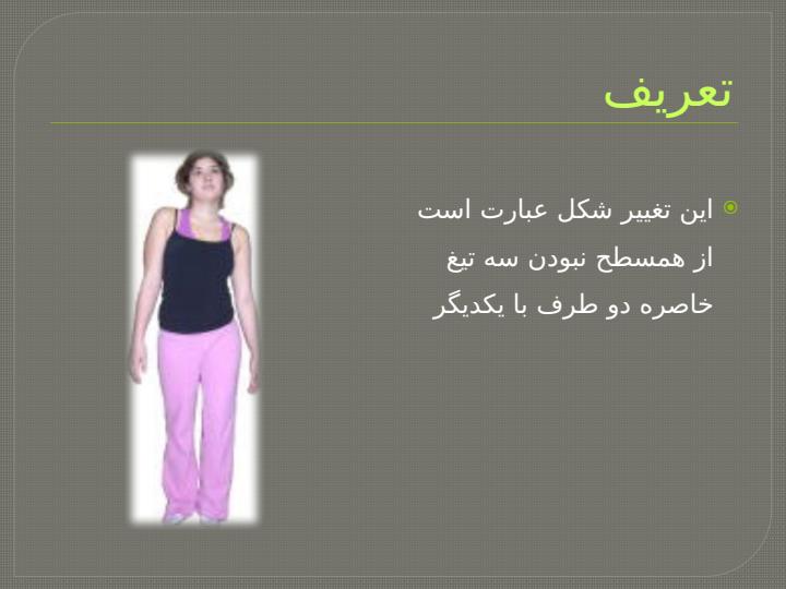 انحراف-جانبی-لگن2
