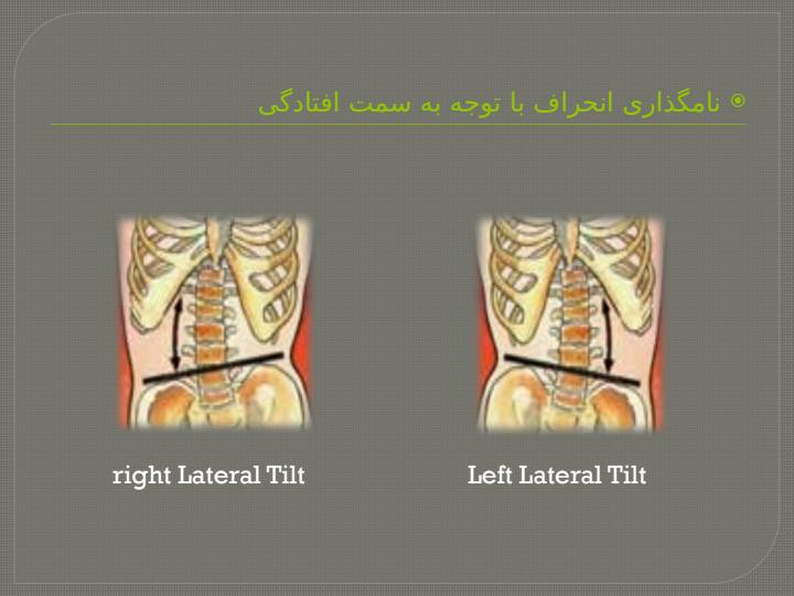 انحراف-جانبی-لگن4