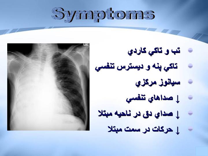 مشكلات-راه-هاي-هوايي-تحتاني5