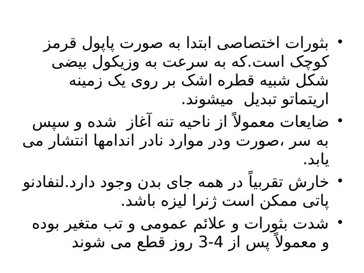 آبله-مرغان6