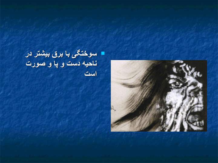ایمنی-برق4