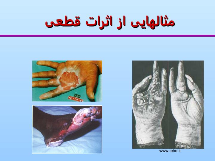 مفاهیم-و-اصول-اساسی-حفاظت-در-برابر-اشعه5