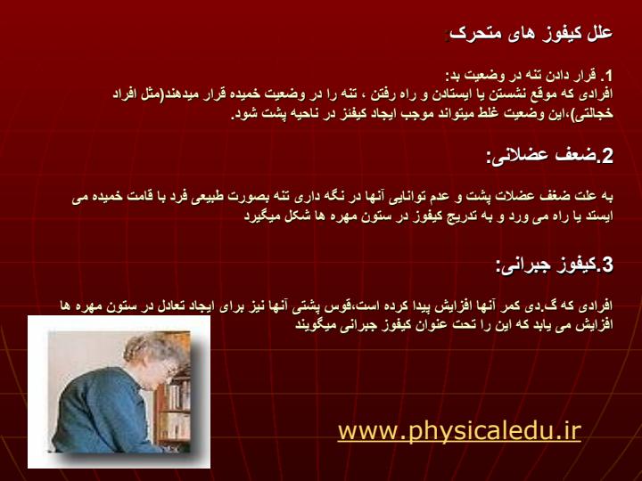 موضوع-تحقیق-پشت-گرد-کیفوز-پشتیKYPHOSIS3