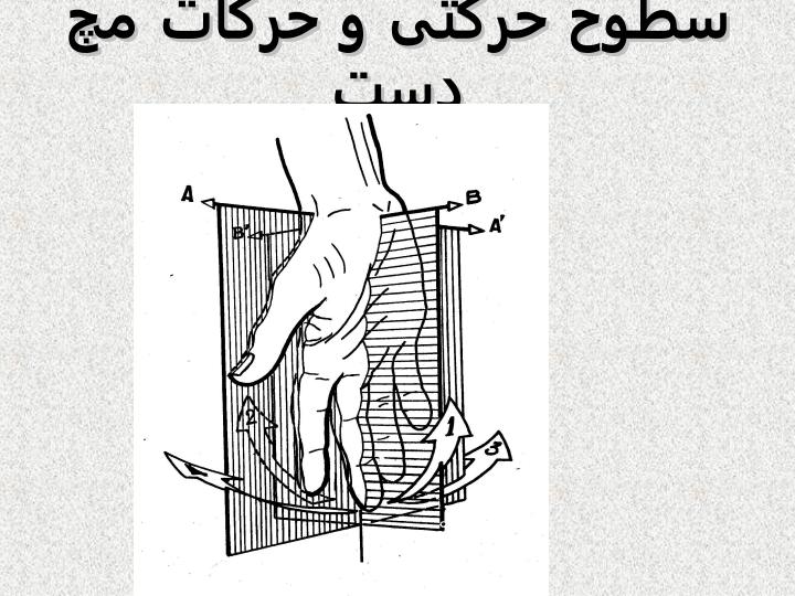 مچ-دست1