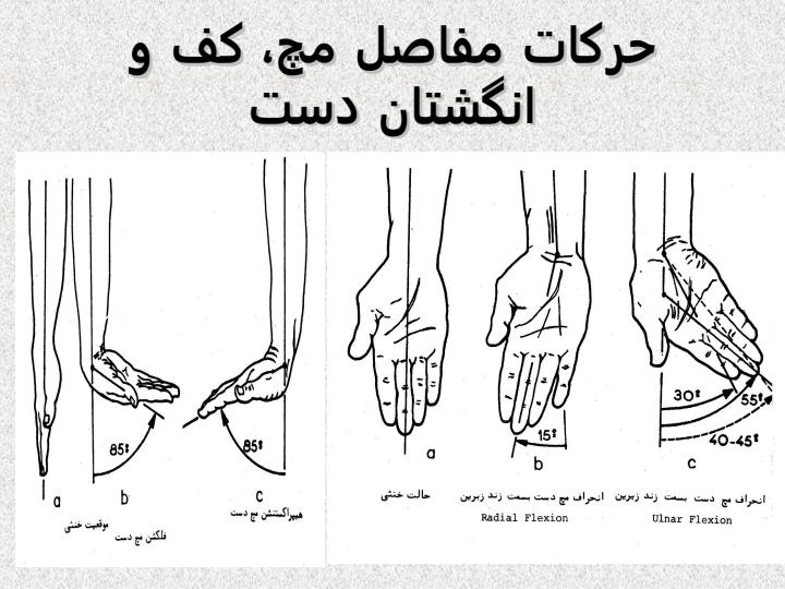 مچ-دست2