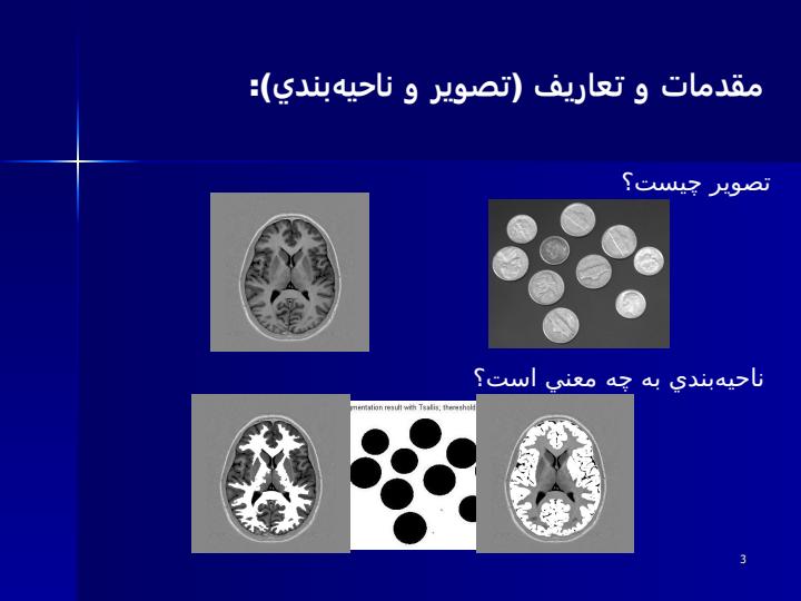ناحيهبندي-تصاوير-تشديد-مغناطيسي-با-استفاده-از-معيار-آنتروپي2