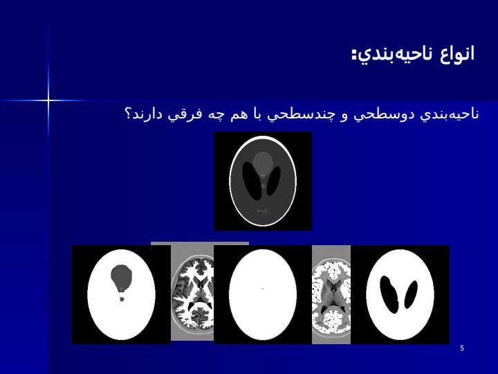 ناحيهبندي-تصاوير-تشديد-مغناطيسي-با-استفاده-از-معيار-آنتروپي4