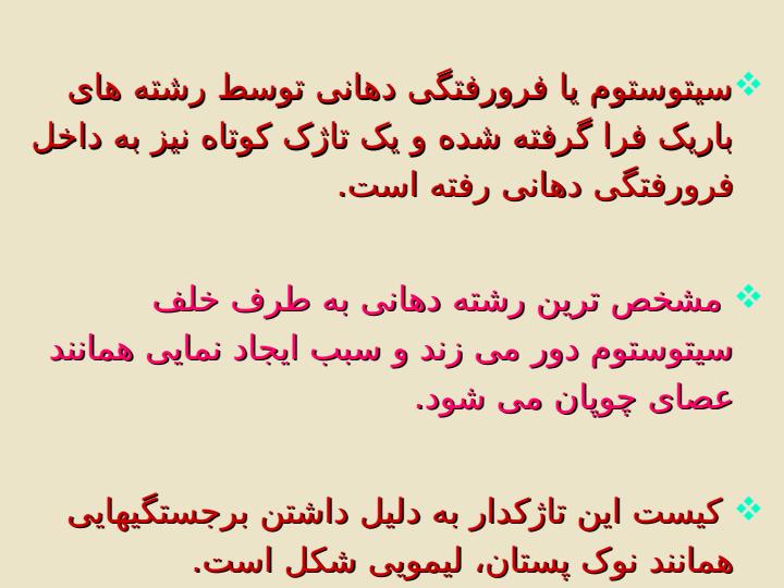 کیلوماستیکس-مسنیلی1