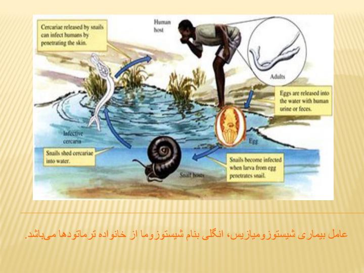 آشنایی-با-بیماری-شیستو-میازیس3