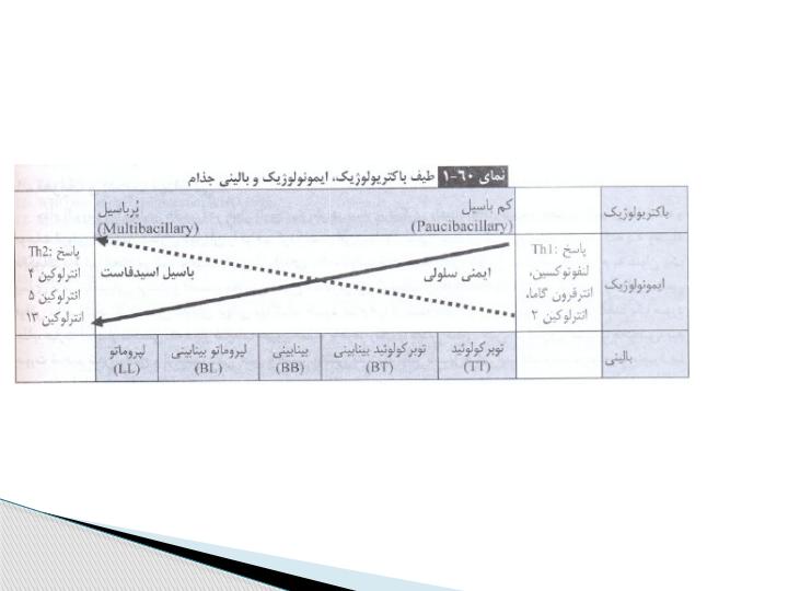 بیماری-هانسن3