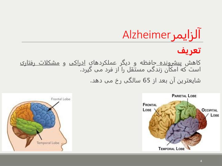 بیماریهای-دستگاه-عصبی3