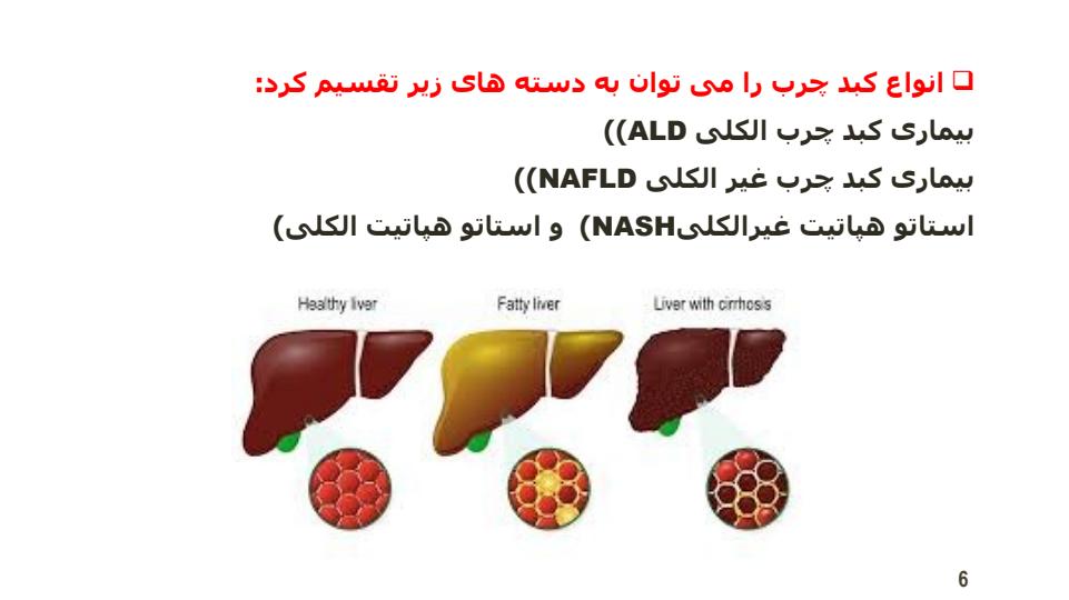 علت-و-درمان-بیماری-کبد-چرب5