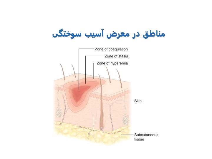 فصل-62-رسیدگی-به-بیماران-دچار-سوختگی5