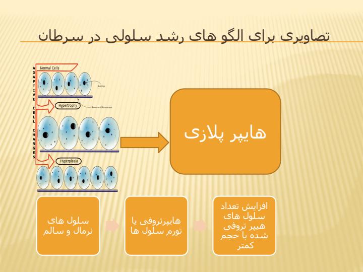 مراقبت-های-پرستاری-از-بیمار-سرطانی4