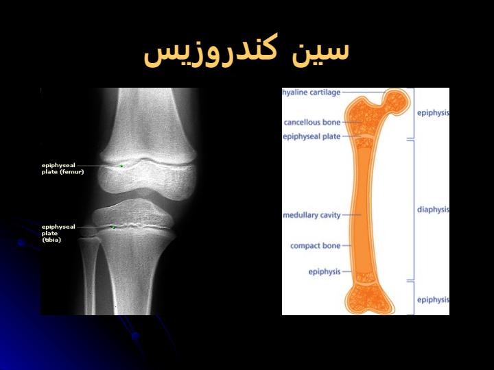 مفصل-و-انواع-مشکلات-و-بیماریهای-مفصل4