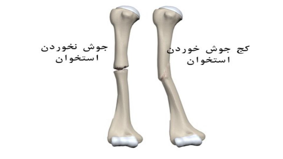 پرستاری-بزرگسالان-ارتوپد3