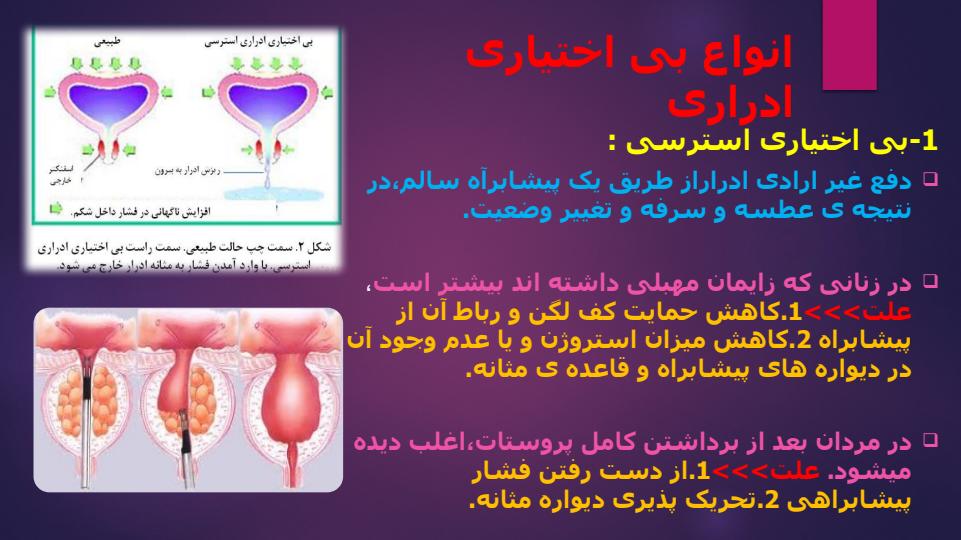 احتباس-ادراری-بی-اختیاری-ادراری4