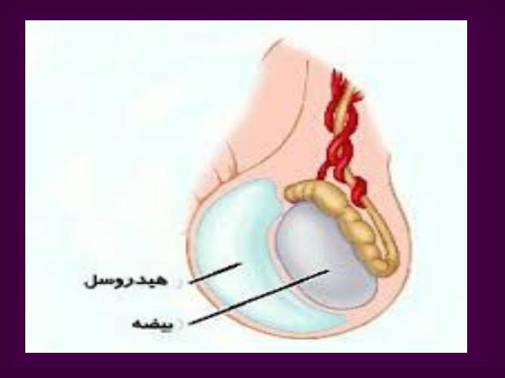 اختلالات-ادراري-تناسلي4