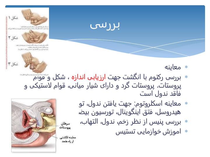 اختلالات-دستگاه-تناسلی-مردان4