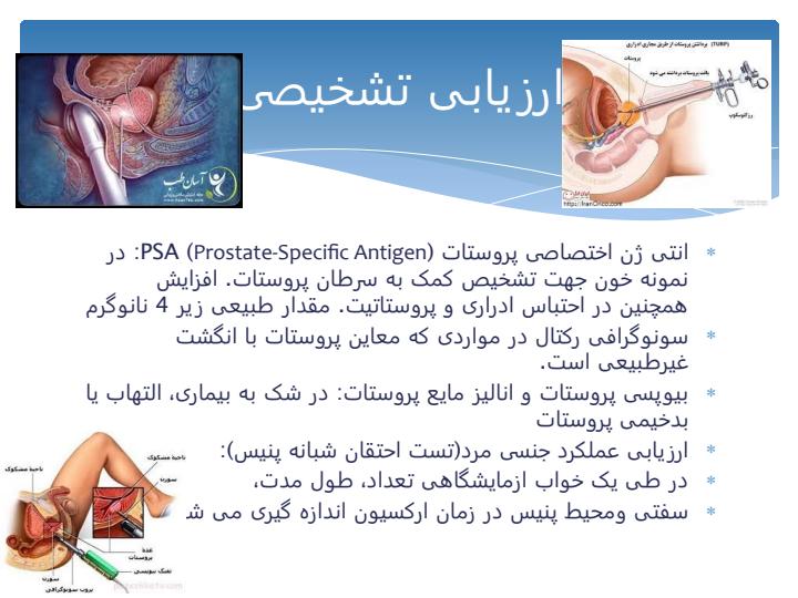 اختلالات-دستگاه-تناسلی-مردان5