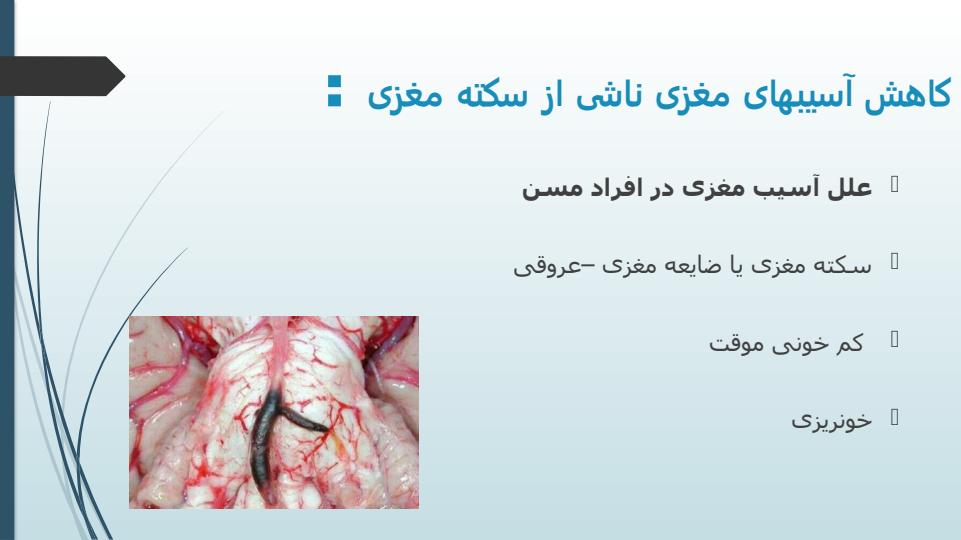 علل-آسیب-مغزی2